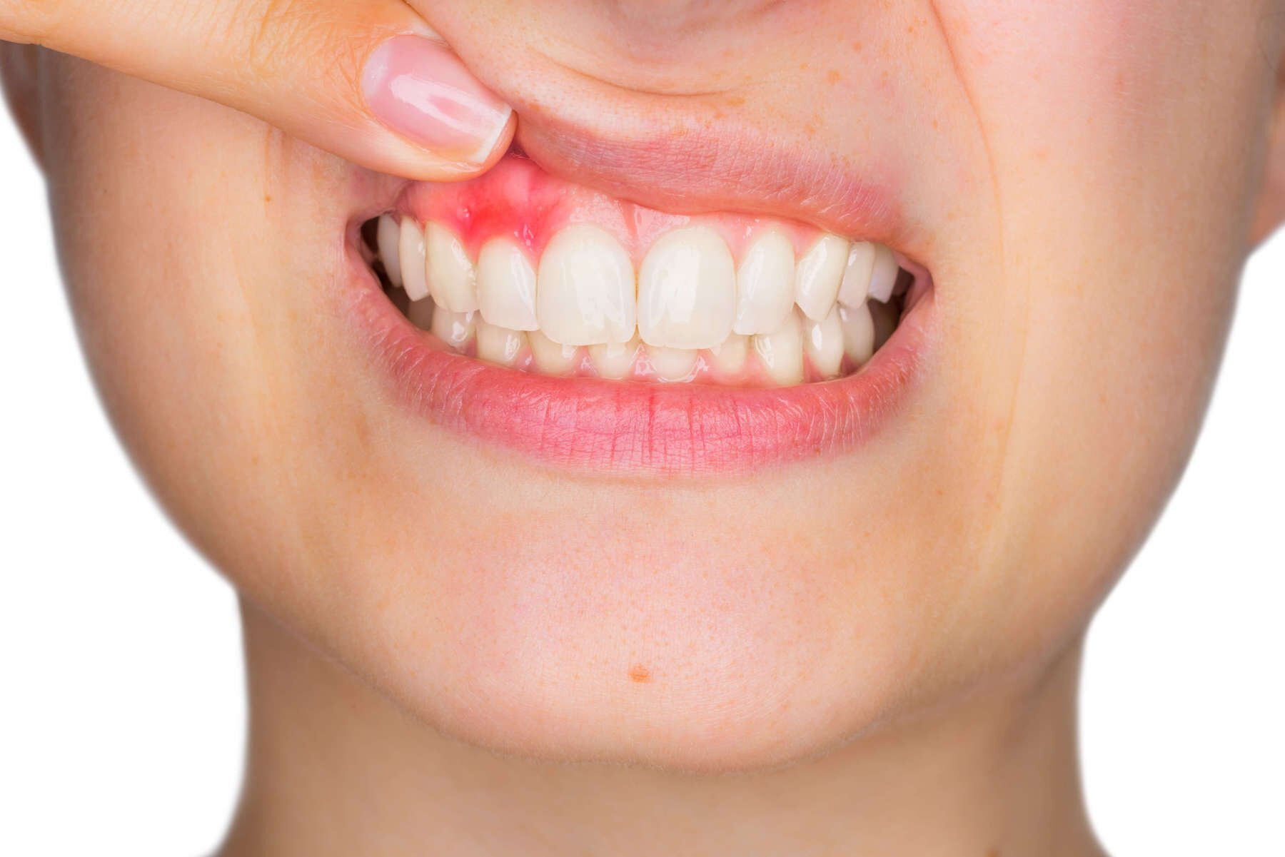 Sapevi che lo stress influenza la salute orale e la perdita dei denti?